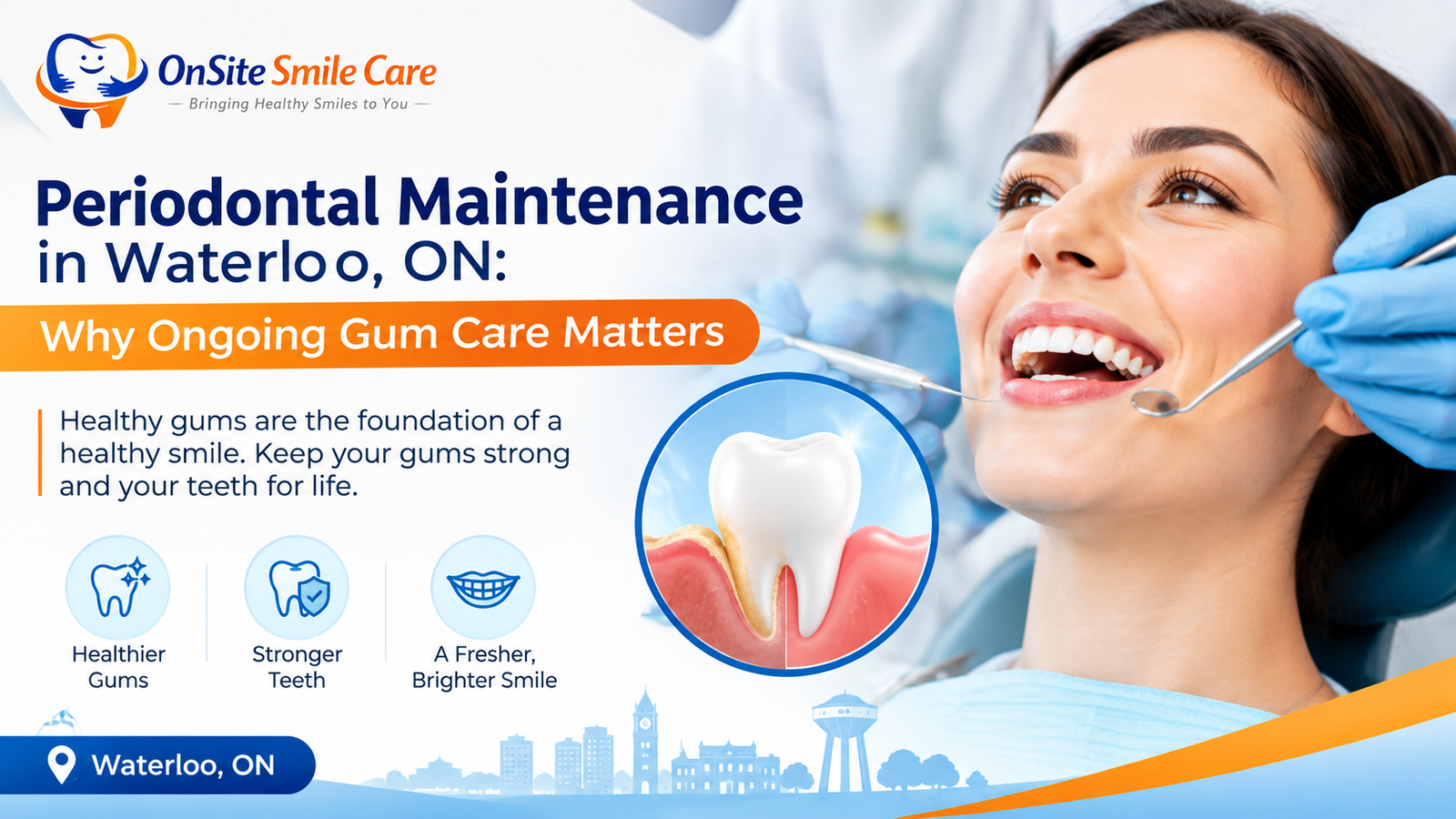 Periodontal Maintenance in Waterloo, ON Why Ongoing Gum Care Matters